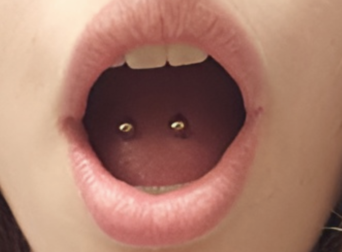 Surface Tongue Piercing